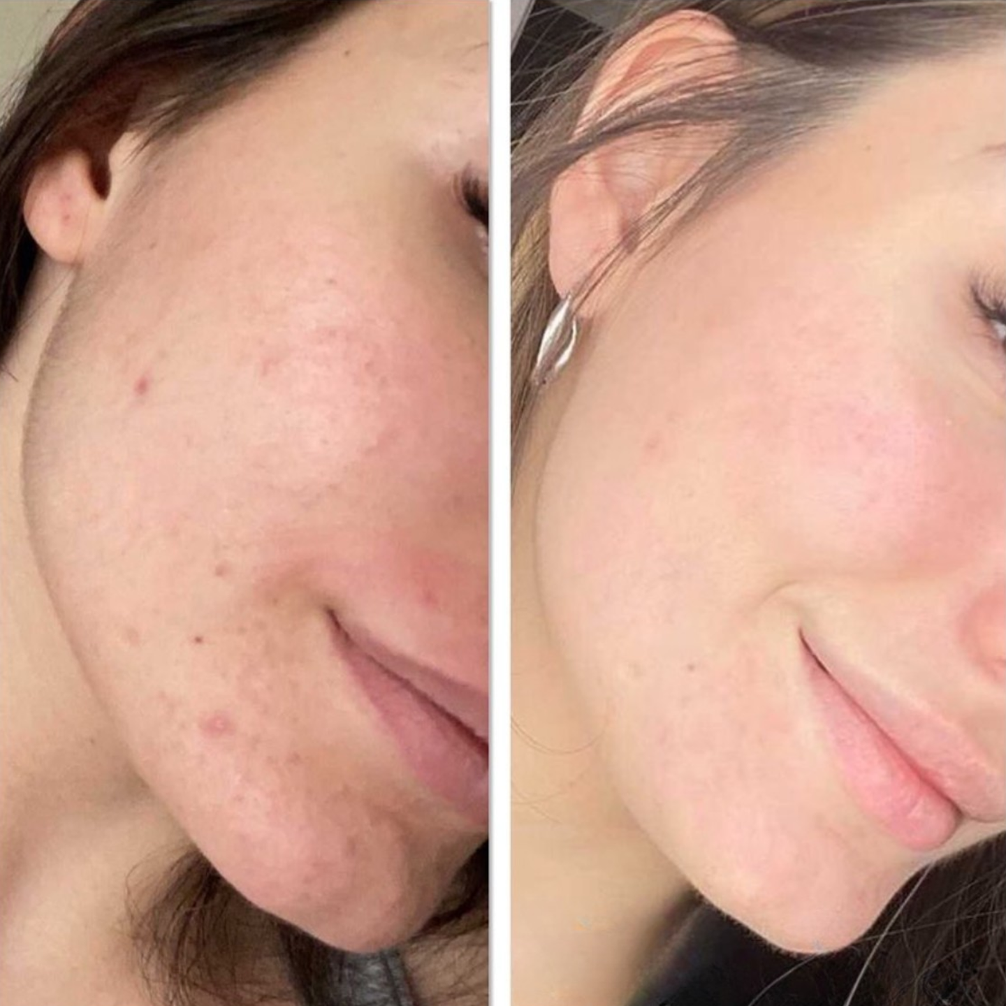 Compléments peau & ongles BiomeFit