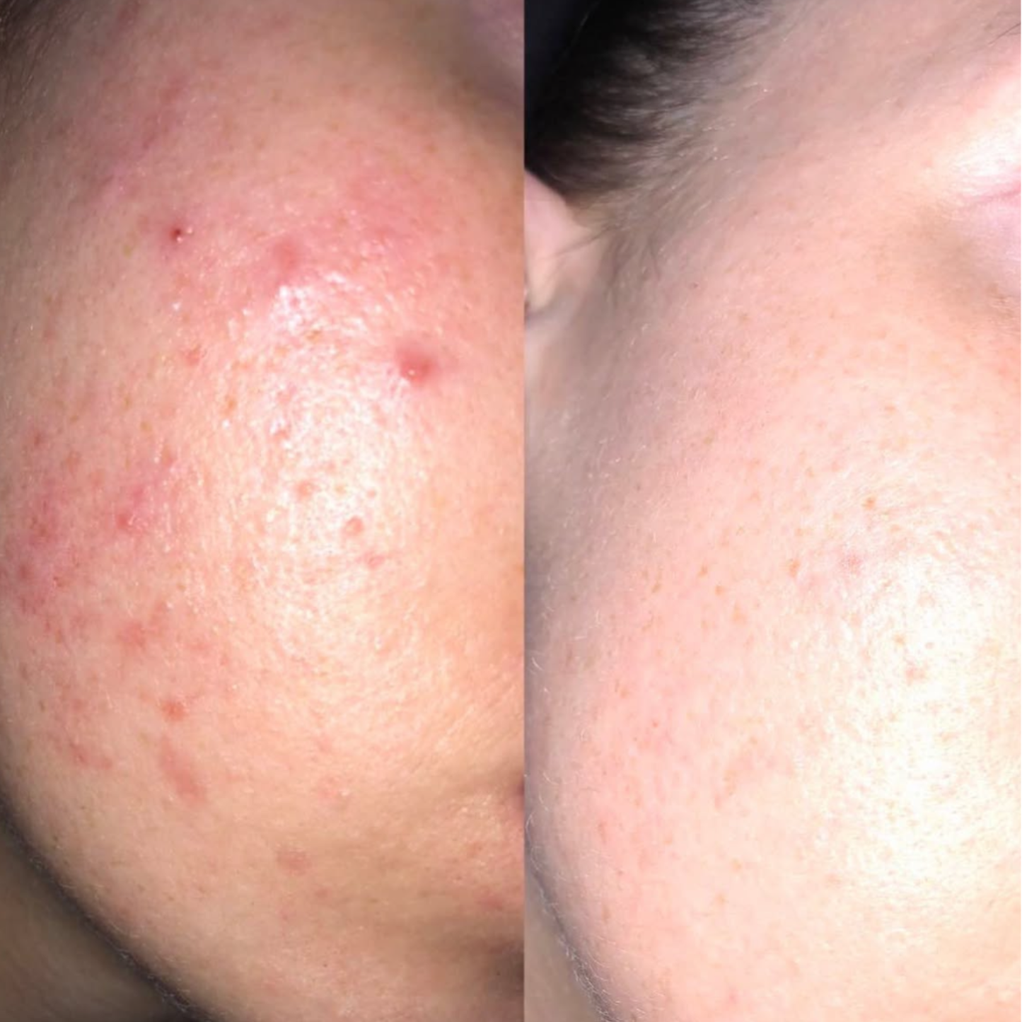 Compléments peau & ongles BiomeFit